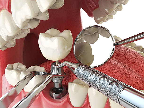 Best Emergency Dental Extractions in Tilden, NE